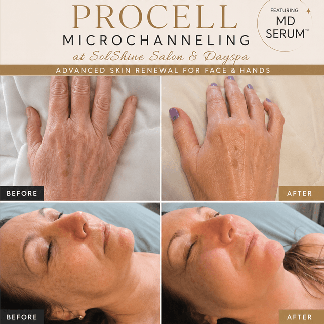 Procell 4 Treatment at SolShine Salon & Dayspa in Laconia, NH